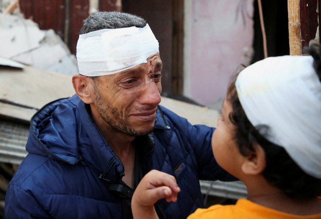 Palestinec s sinom, potem ko sta bila ranjena med enim od izraelskih napadov. FOTO: Hatem Khaled/Reuters