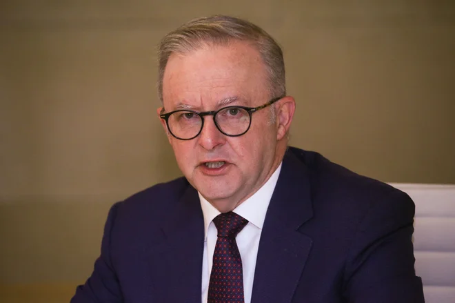 Anthony Albanese. FOTO: Gaye Gerard/Afp