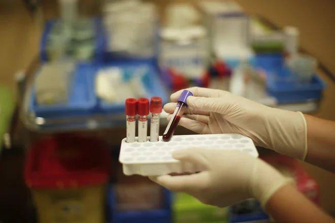 Šest tisoč pacientov ZD Ljubljana, starih med 30 in 34 let, je marca domov prejelo vabilo za preventivno presejalno testiranje na bakterijo Helicobacter pylori (projekt Togas), v ZD Maribor pa so že pred pol leta na testiranje povabili štiri tisoč pacientov (projekt Eurohelican). FOTO: Jure Eržen