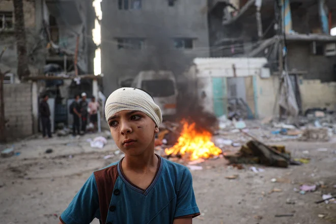 Ranjeni palestinski deček ob ruševinah stavb, ki so jih povzročili izraelski napadi. FOTO: AFP