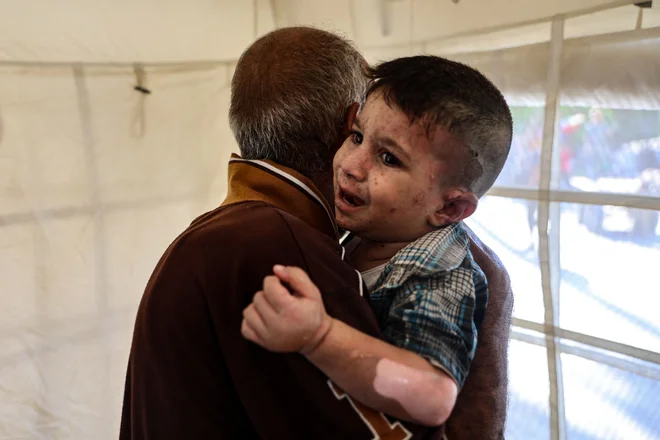 Palestinski deček čaka na zdravljenje opeklin v bolnišnici al Mamadani, ki jih je dobil po napadu izraelske vojske na šolo, v katero so se zatekli razseljeni Palestinci. FOTO: Omar Al-qattaa/Afp