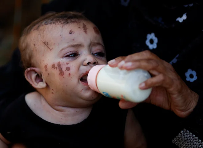 Reem Abu Haya, palestinska deklica, ki je preživela izraelski napad, v katerem je umrla vsa njena družina, hrani sorodnica v bolnišnici Nasser v Khan Younisu na jugu Gaze. Foto: Mohammed Salem/Reuters