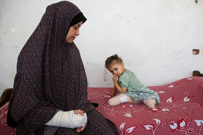 Gaza je postala območje z največ otroki, ki imajo amputirane ude, na svetu na prebivalca. FOTO: Hatem Khaled/Reuters