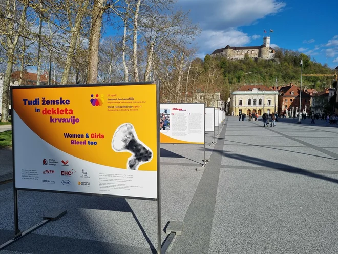 Razstava na Kongresnem trgu predstavlja pričevanja žensk in deklet, ki se soočajo z motnjo strjevanja krvi. FOTO: Mitja Kavčič