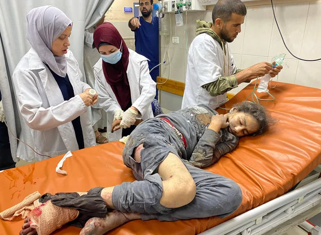Izrael nadaljuje napade. V bombardiranju civilnih domov na severu Gaze je bilo ubitih najmanj 50 ljudi, še več deset je ranjenih. V Indonezijsko bolnišnico v Bejt Lahiji so prepeljali več kot 30 mrtvih in več deset ranjenih, med njimi večinoma otroke in ženske. Iz bolnišnice v Džabaliji pa poročajo o najmanj petih mrtvih in 75 ranjenih. Včeraj je Izrael v Gazi ubil najmanj 136 ljudi. Od začetka vojne v Gazi je bilo ubitih več kot 53.000 Palestincev, od tega več kot 17.000 otrok, ranjenih pa skoraj 120.000. Foto: Afp