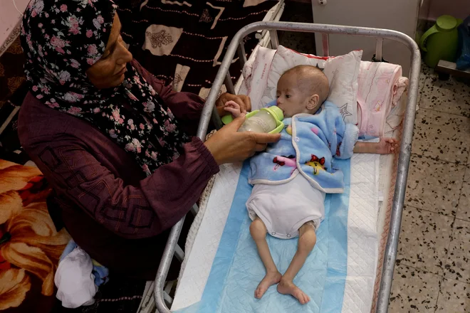 Israel under the avalanche of criticism due to humanitarian blockage of gauze