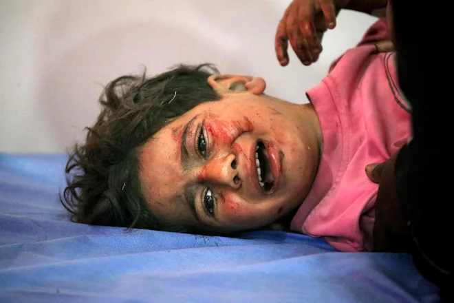 V izraelskih napadih je umrlo in bilo ranjenih ogromno otrok. FOTO: Eyad Baba/AFP