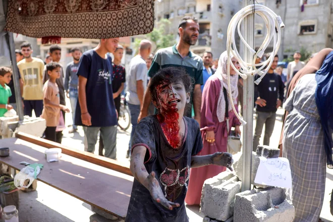 Tako na severu kot na jugu Gaze se danes nadaljujejo intenzivni izraelski napadi. Na celotnem območju oblegane palestinske enklave je bilo od jutra ubitih najmanj 66 Palestincev. Razmere se zaostrujejo na različnih območjih v Gazi. Tamkajšnja civilna zaščita je sporočila, da je bilo samo v enem izraelskem napadu na mesto Sabra ubitih najmanj 15 ljudi, še 50 pa ranjenih. Dogajanje je opisala kot popoln pokol. Foto: Bashar Taleb/Afp