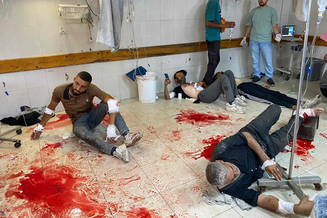Palestinci, ki so bili ranjeni v današnjem izraelskem napadu v bližini centra za pomoč, kjer so razdeljevali hrano, čakajo na oskrbo v bolnišnici Nasser v Khan Yunisu na jugu Gaze. Izraelske sile so ubile najmanj 47 ljudi in jih več kot 200 ranile, ko se je na tisoče Palestincev zjutraj zbralo v centru za pomoč, da bi dobili moko. Izraelska brezpilotna letala so streljala na Palestince, nekaj minut pozneje pa so izraelski tanki izstrelili več nabojev, zaradi česar je bilo veliko število ljudi ranjenih. Foto: Afp