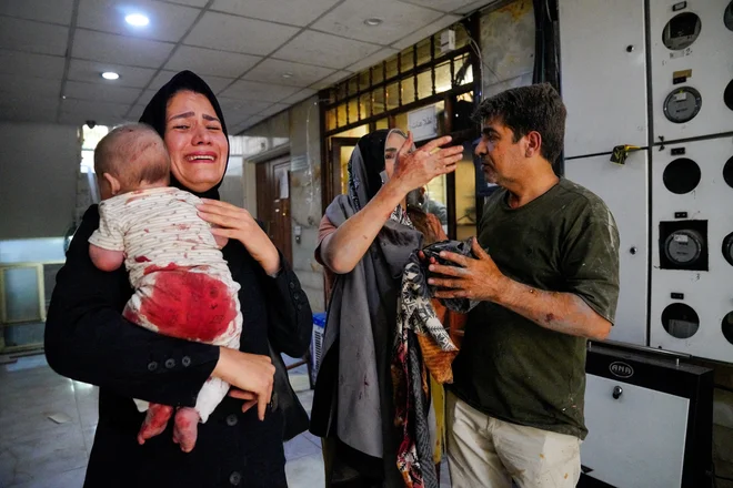 Iranske oblasti so sporočile, da je bilo v današnjih izraelskih napadih ubitih 224 ljudi, 1277 pa je bilo ranjenih. FOTO: Amir Kholousi/Reuters