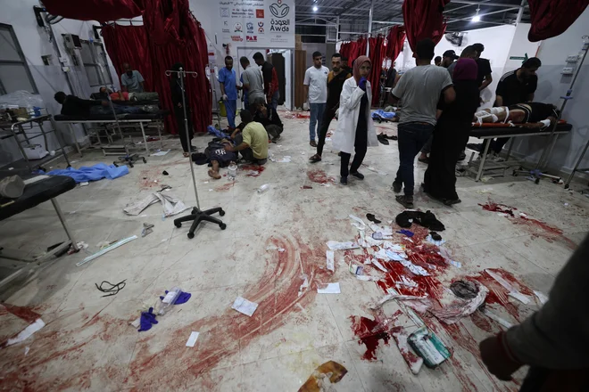 V napadu je umrlo 21 ljudi, okoli 150 je ranjenih. FOTO: AFP