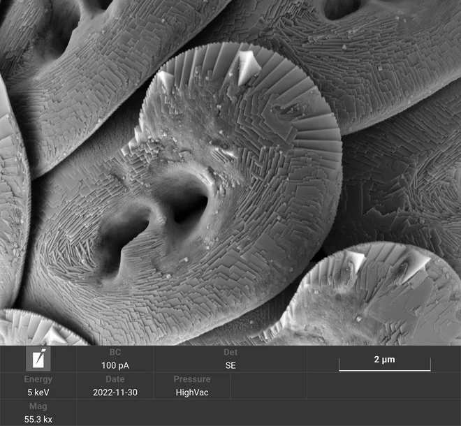 Posamezni kokolit vrste Helicosphaera carteri, posnet z vrstičnim elektronskim mikroskopom (SEM) FOTO: Morska biološka postaja


 

