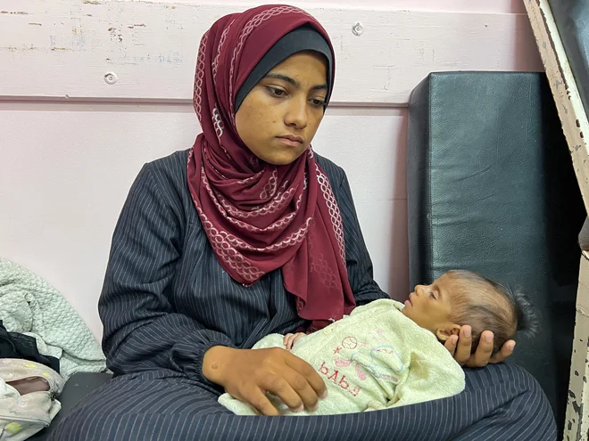 Palestinka, ki v naročju drži podhranjeno hčerko. FOTO: Hussam Al-masri/Reuters
