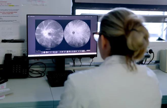 V genu PHB1 lahko nastanejo mutacije, ki povzročajo okvaro vidnega živca oziroma optično atrofijo. FOTO: Blaž Samec